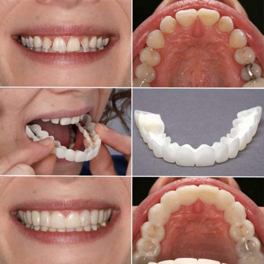 Comfortable False Teeth Covers - One Size Fits All